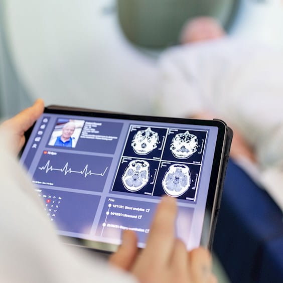 medical professional reviewing brain scans on an ipad